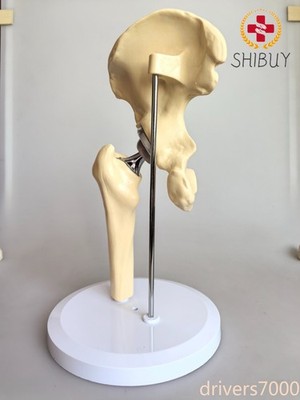 Size Hip Joint Replacement Medical Anatomical Skeleton Model Artificial 1:1