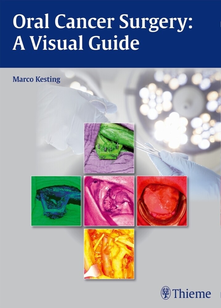 Thumbnail - Oral Cancer Surgery | Marco Kesting | A Visual Guide | Buch | 132 S. |