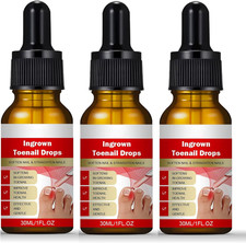 3PCS Ingrown Toenail Treatment Drops Nail Softener & Cuticle Care Oil 10ml