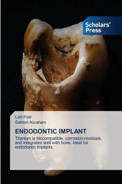 Lalit Patil (U. A.) | Endodontic Implant | Taschenbuch | Englisch (2025)-image