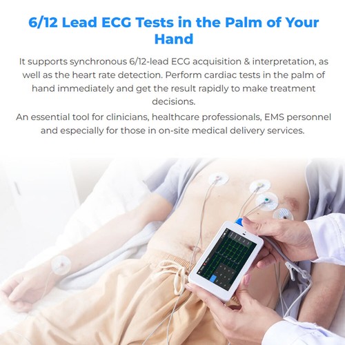 NEW 6/12-lead Electrocardiograph ECG EKG Machine + Glasgow ECG Interpretation - Picture 5 of 19