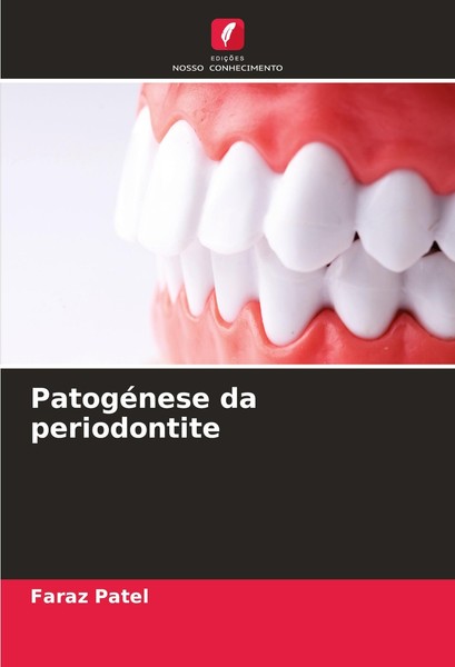 PatogéNese Da Periodontite Faraz Patel-image