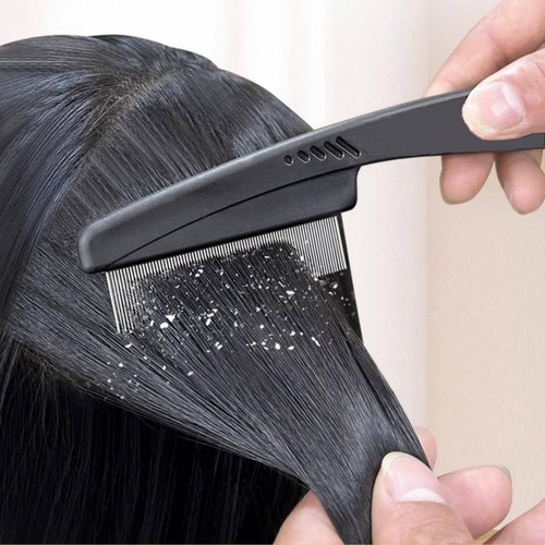 Dandruff Comb, Stainless Steel Fine Tooth Dandruff Remover, Professional Scal... - Picture 5 of 6