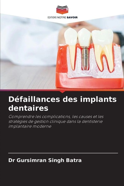 Gursimran Singh Batra | DéFaillances Des Implants Dentaires | Taschenbuch (2025)-image