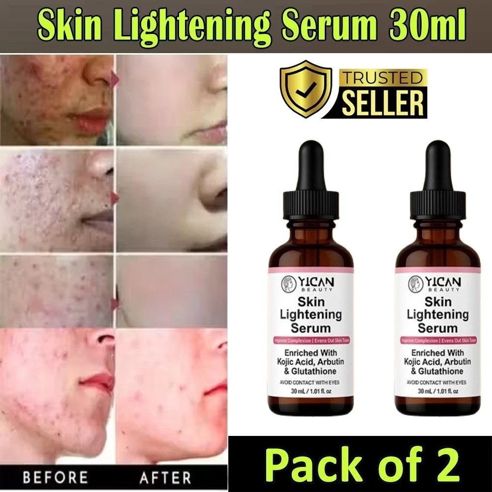 Skin Whitening Serum - Lighten Body Blemishes, Brighten Skin Tone, Protect Skin