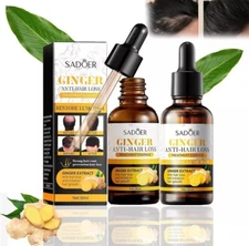 Sadoer Ginger Anti-Hair Loss Treatment Essence 30ml – Restore Hair Growth & Lush