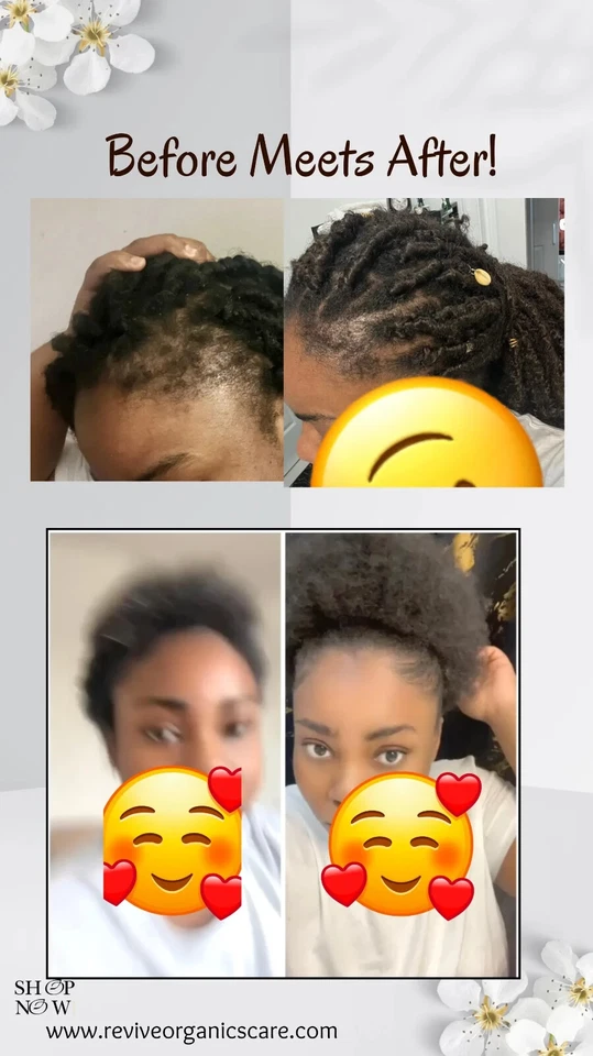 Organic Hair Growth Oil- Alopecia Treatment , Rosemary Infused with Herbs, - Image 4 of 4