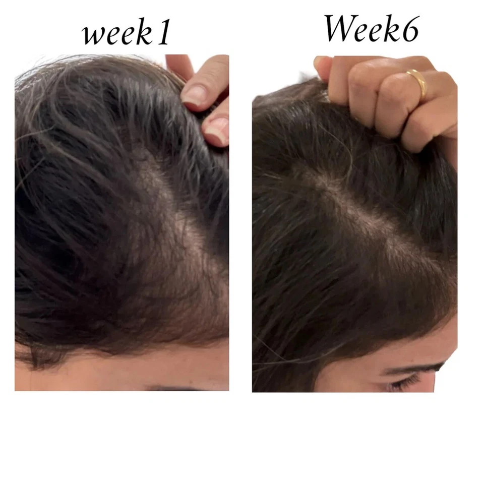 BEST SELLER BOOSTER, Raw African Booster Ampoules Are Changing The Game🇪🇬 - Image 3 of 4