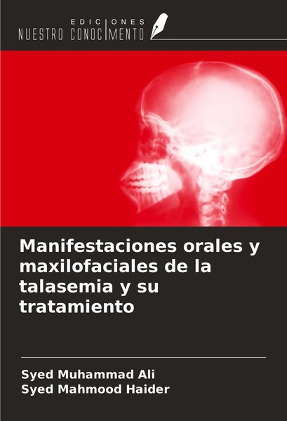 Manifestaciones Orales Y Maxilofaciales De La Talasemia Y Su Tratamiento Syed Ma-image