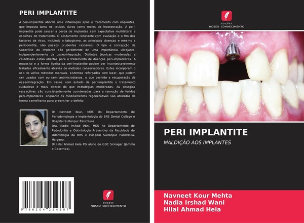 Peri Implantite Navneet Kour Mehta-image