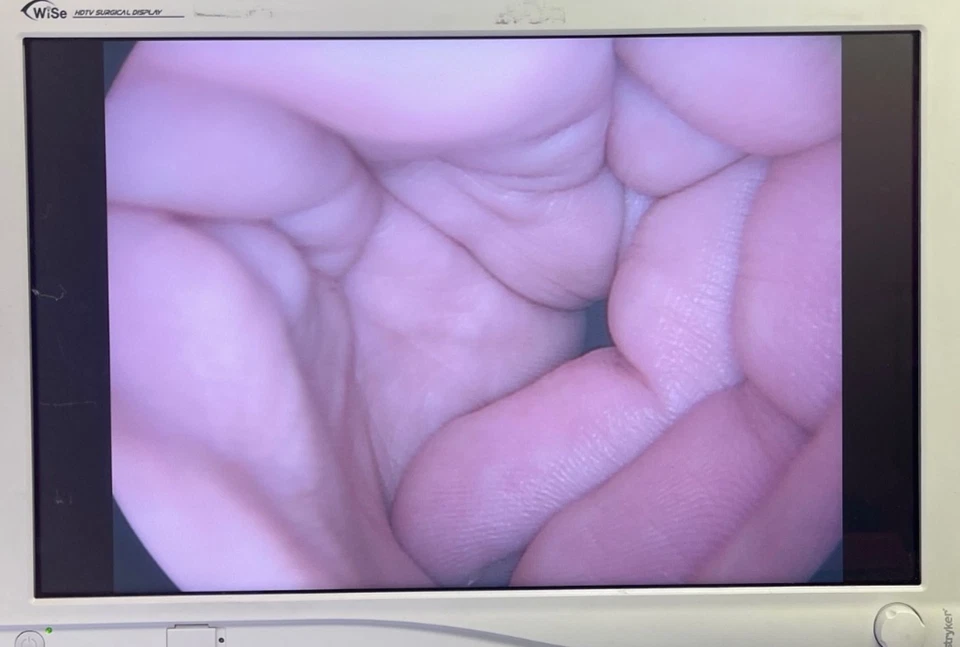 Laparoscopio endoscopia laparoscopia Cabot Medical 004873-901 10 mm x 0° Foto 2 de 4