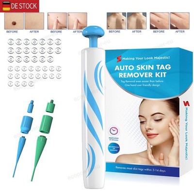 2in1 Warzenentferner Kit Warze Papillome Skin Tag Remover Schmerzloser Entferner
