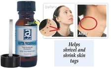 QUITA VERRUGA SKIN TAG REMOVER SANI SKIN WART REMOVER HOMEPATHIC