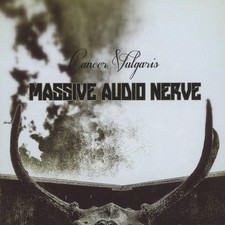 Massive Audio Nerve Cancer Vulgaris (CD)