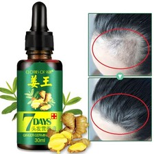 1-3Pcs 7-Days Hair Growth Serum Oil, Hair Regrowth Serum, Ginger Germinal Oil UK
