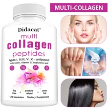 (Type I,II,III,V,X) Multi Collagen Peptides Capsules-Hydrolyzed Protein Peptides