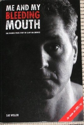 ME AND MY BLEEDING MOUTH PB: The Painful Story of Gary  by WELLER SUE 1904459145