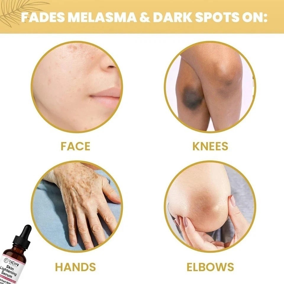 Skin Whitening Serum - Lighten Body Blemishes, Brighten Skin Tone, Protect Skin