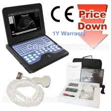 Tragbarer digitaler Ultraschallscanner im Laptop-Format mit 3,5-MHz-Konvexsonde