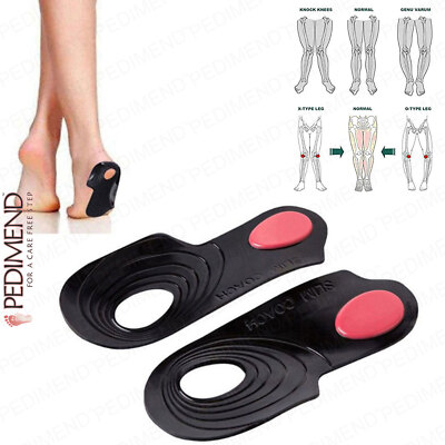 Pedimend O/X Typ Bein orthopädische Einlegesohle (1 PAAR) - Fußkorrekturpolster - UK