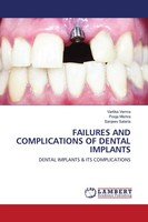 Failures AND Complications OF Dental Implants Vartika Verma (U. A.) Taschenbuch