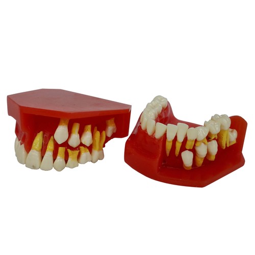Dental Model Deciduous Teeth Permanent Tooth Alternate Demonstration 9-12 Child - Picture 4 of 5