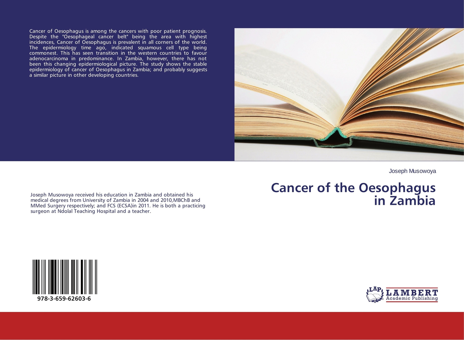 Thumbnail - Cancer Of The Oesophagus In Zambia Joseph Musowoya Taschenbuch