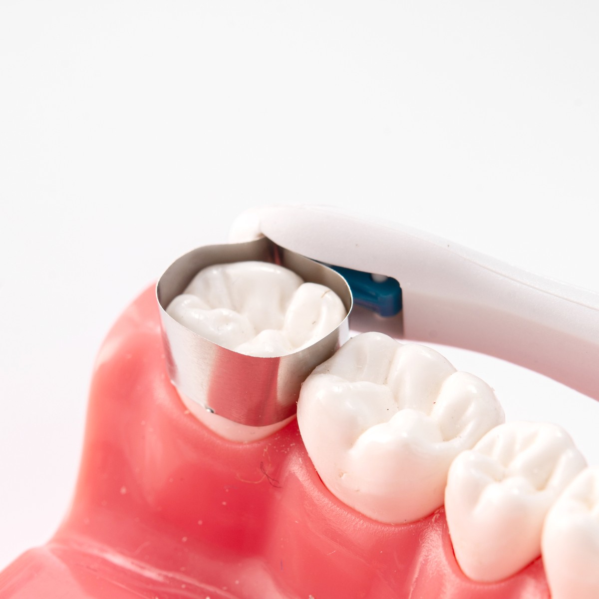 10 Bandes Matrices Dentaires Easyinsmile – Prémolaires Pédiatriques, Préformées Métal