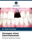 Akshi Varshney | Versagen Eines Zahnimplantats | Taschenbuch | Deutsch (2024)