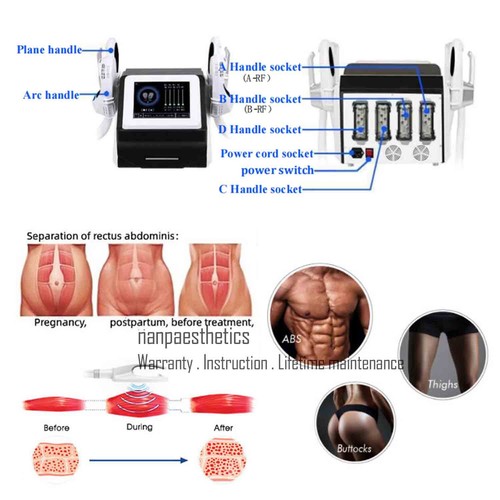 4 asas EMS BODY MUSCLE NEO máquina R-F escultura construcción músculo cintura pieza de mano - Imagen 3 de 35