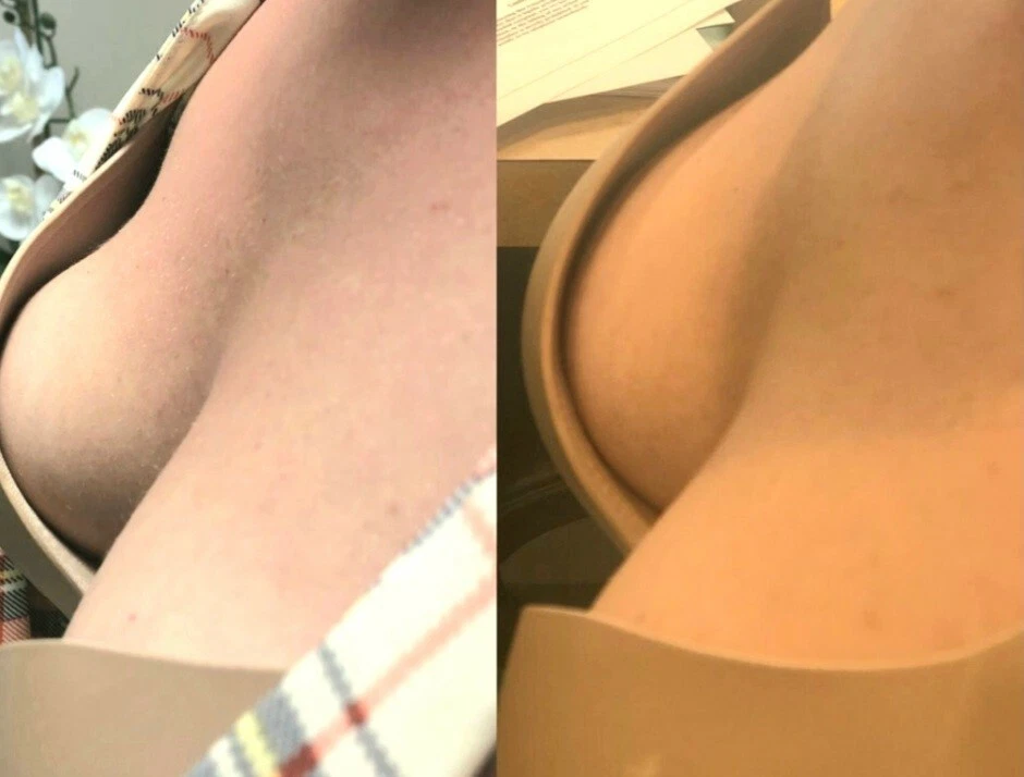 Bigger Boobs/Breast Cream/Oil - Image 4 of 4