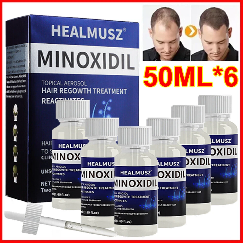 6 Month Supply Extra Strength MINOXIDIL 5% Serum Hair Growth FOR MEN (6pcs)