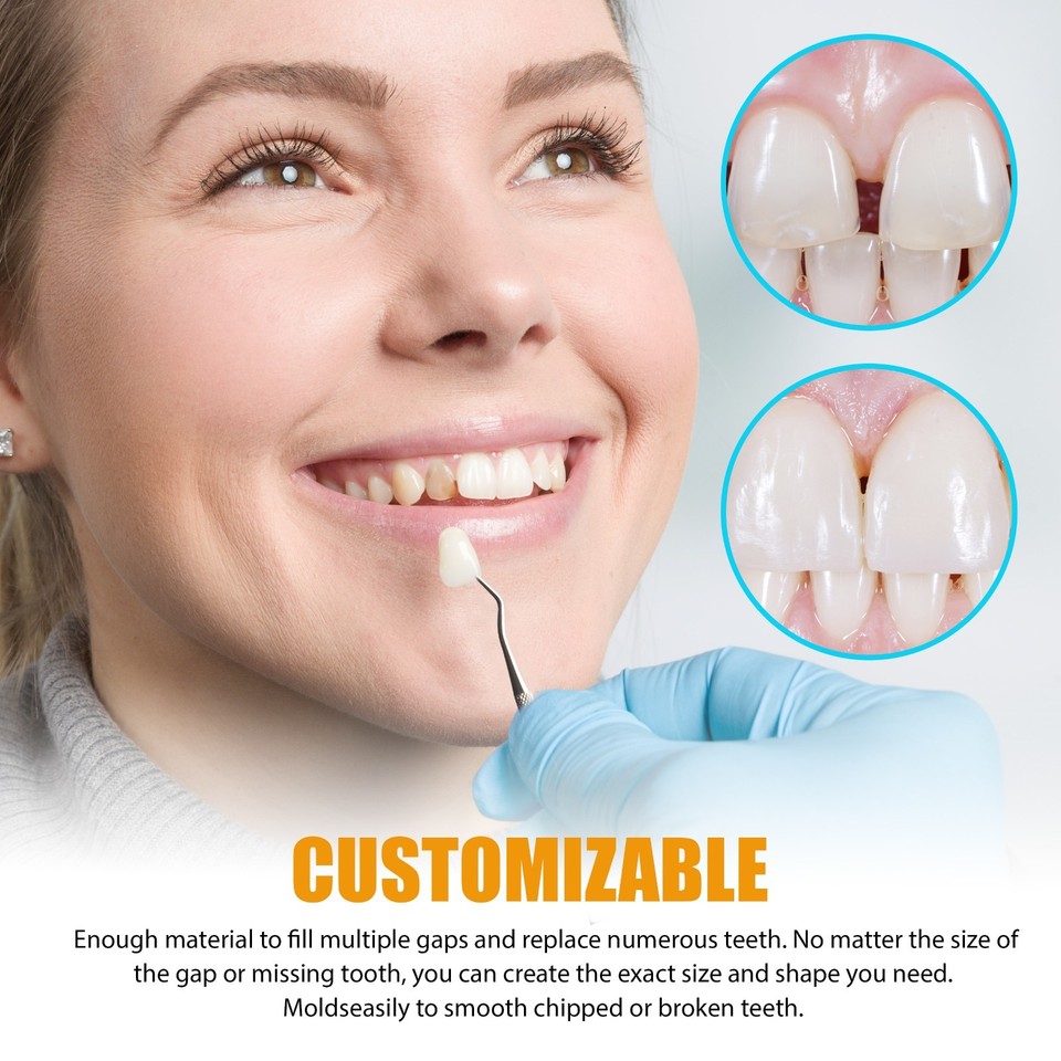 Temporary Tooth Gap Filler – Instant Tooth Substitute, Cosmetic Dental ...