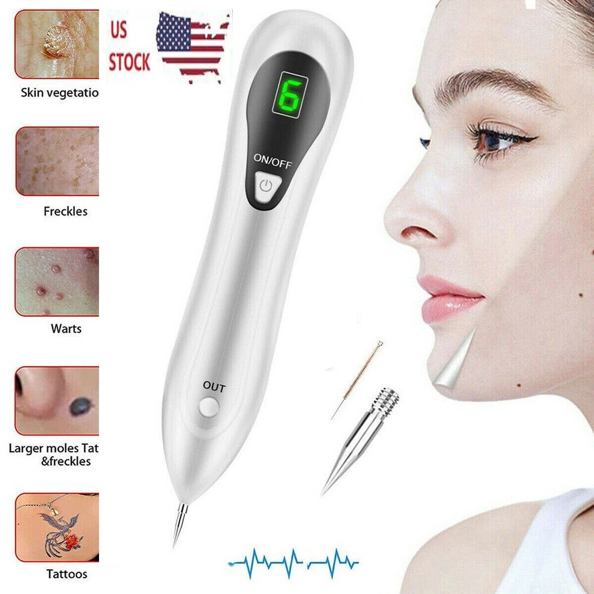 Electric Laser Plasma Pen Mole Removal Dark Spot Remover Skin Wart Tag Tattoo