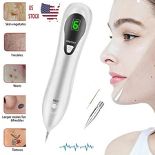 Electric Laser Plasma Pen Mole Removal Dark Spot Remover Skin Wart Tag Tattoo
