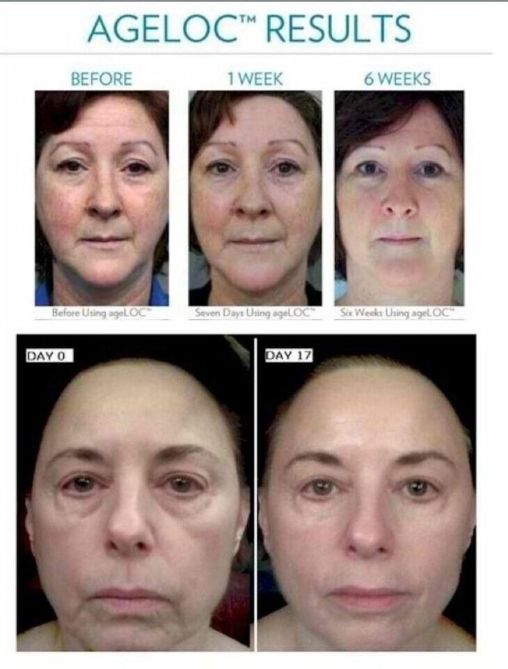 NU SKIN NUSKIN AGELOC GALVANIC BODY SPA PACK SYSTEM FULL SET NU SKIN NUSKIN AGELOC GALVANIC BODY SPA PACK SYSTEM FULL SET