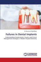 Gursimran Singh Batra | Failures In Dental Implants | Taschenbuch | Englisch