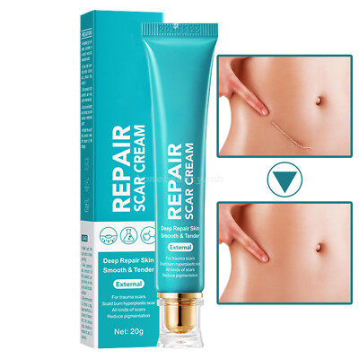 20g Scar Repair Cream Fast Removal Epidermal Scars Cream Smooth Tender