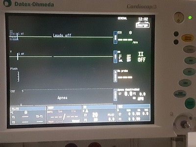 Datex-Ohmeda Cardiocap/5:NMT, NIBP, ECG, SpO2, 2x IBP, 2x Temp, PRINTER, 5 Agent