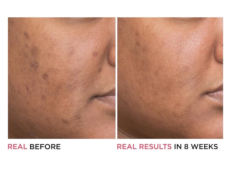 Authentic Somali Qasil Powder, For Skin & Hair, Pack Of  1, 2oz - Image 4 of 4