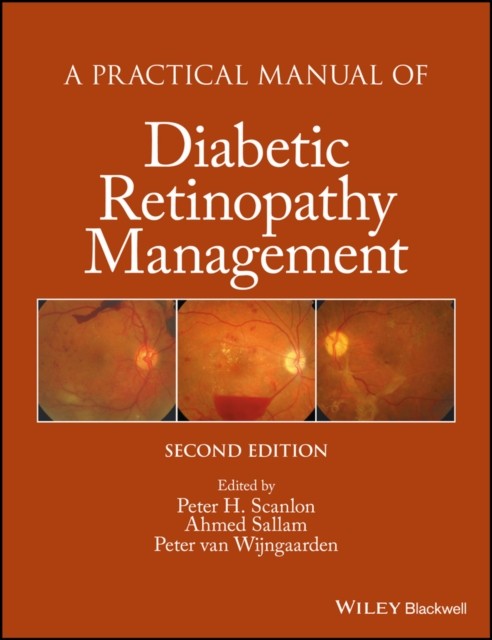 A Practical Manual of Diabetic Retinopathy Management 2e Scanlon Hardback