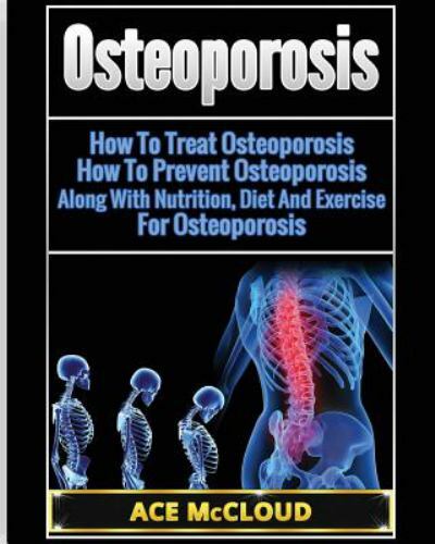Osteoporosis : How to Treat Osteoporosis: How to Prevent Osteoporosis: Along ...
