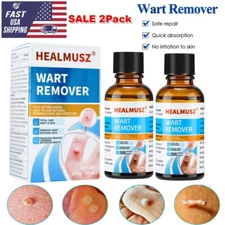 2Pack Wart Remover Liquid Skin Tag Mole Remover Eliminate Feet Corn Wart Remove