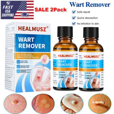 2Pack Wart Remover Liquid Skin Tag Remover Eliminate Feet Corn Wart Remove Oil