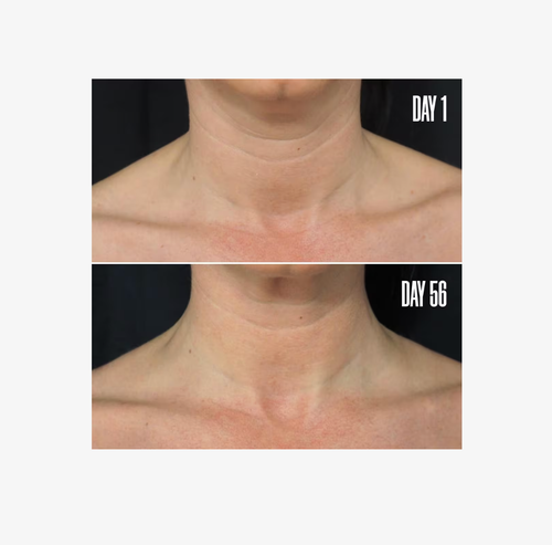 MAËLYS B-POISED Neck & Décolleté Firming Cream, Moisturize, Free Ship (1.7 oz) - Picture 5 of 7