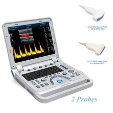 Macchina scanner ultrasuoni Doppler a colori portatile sistema diagnostico lineare convesso