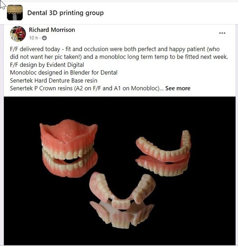 DLP SLA LCD 3d printer denture base resin for manufacturing dentures - Picture 13 of 25