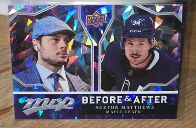 2021-22 Upper Deck MVP Auston Matthews Before & After #BA-1 Toronto Maple Leafs