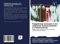 Gidroxid Kal'ciq I Ego Shirokoe Ispol'zowanie W Stomatologii AngéLica Maria Riwe