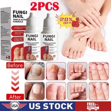2PCS Fungi Nail Anti Fungal Liquid Formula Nail Repair Liquid Solution 15ml